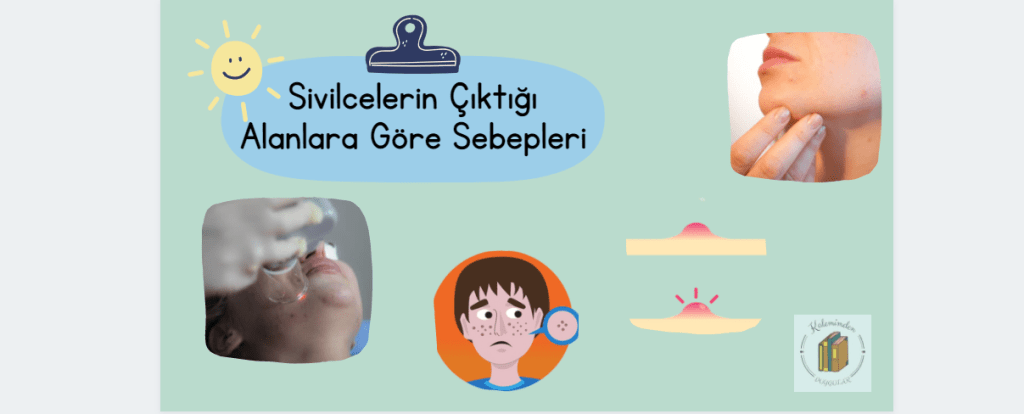 Sivilcelerin Çıktığı Alanlara Göre&nbsp;Sebepleri